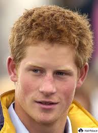 Prince Harry Hair Transplant | A Royal ...