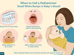 The two small bumps at the back of the mouth in the tonsil area are called hamulii. Epstein Pearls Definition Traits Causes Treatment