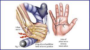 Pinpoint your symptoms and signs with medicinenet's symptom. How To Avoid Sore Hands From Mountain Biking Total