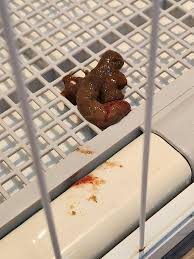 Image result for Blood in stool