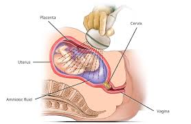 Image result for Ultrasound