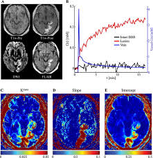 Последние твиты от bbb (@bbb_us). Analyzing The Blood Brain Barrier The Benefits Of Medical Imaging In Research And Clinical Practice Sciencedirect