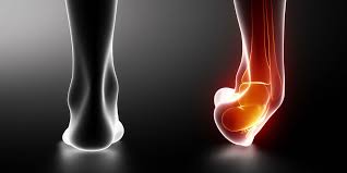This indicates that the ligament has a. Types Of Ankle Sprains Heiden Orthopedics