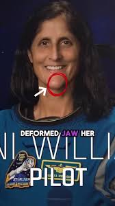Sunita Williams' Struggles After Space Return