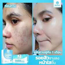 mana pure collagen plus thailand best selling products online shopping worldwide shipping collagen dull skin pure products