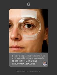 Charles Demo Souza (@drcharlesoftalmologista) • Instagram photos and videos