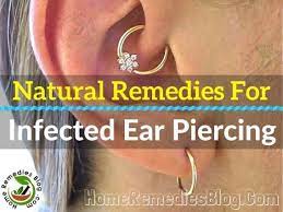 People Go With Current Trend And Body Piercing Is One Of Them Humans Have Evolved Over Infected Ear Piercing Cartilage Piercing Infection Ear Piercings Helix