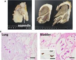 Image result for Pseudoeriosema borianii