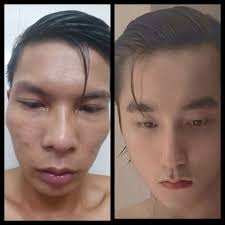 YouTuber nghèo nhất VN" bị dè bỉu ngoại hình, được tài trợ làm răng vẫn nói  1 câu bất ngờ