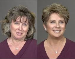 Before and after renovation opinions and costs