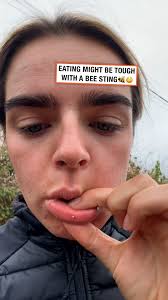 It all happened so fast 😂🐝