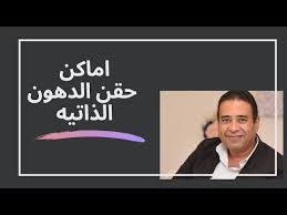 حقن الدهون الذاتية تحت العين من الإجراءات التجميلية التي تود الكثير من الفتيات والسيدات الخضوع لها لإخفاء الها poster movie posters pandora screenshot