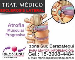 Tratamiento para la esclerosis lateral amiotrófica familiar. Esclerosis Lateral Amiotrofica Ela Dr Jose Martinez Zona Sur Quilmes Buenos Aires