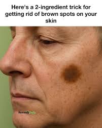 Do you guys have a brown spots