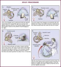 Image result for Oculovestibular Testing