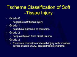 • commonly classified according to the tscherne classification. Closed Fractures Of The Tibial Diaphysis David L
