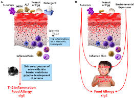 Image result for Staphylococcus Aureus