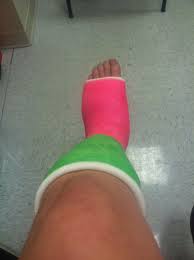 My First Cast Ankle Cast It Cast Fashion