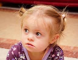 Schau dir unsere auswahl an down syndrome baby an, um die tollsten einzigartigen oder spezialgefertigten, handgemachten stücke aus unseren shops zu finden. Down Syndrom Beim Baby Eine Familie Berichtet Kidsgo