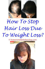 Best Remedy For Hair Loss Hair Loss Treatment Hair Loss Women Hair Loss