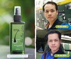 Maybe you would like to learn more about one of these? Hair Growth Oil Neo Hair Lotion 100 Effective Hair Loss Treatment