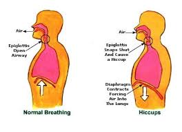 Segera saja, dia ikut terjun di atas tempat tidur, dengan tanpa memakai pakaian. Cara Cara Untuk Hilangkan Sedu Dengan Cepat Aerill Com Lifestyle