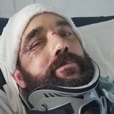 Cagnotte pour Joshua Graff organisée par Mandy Konecki : Help Josh Graff  Rebuild His Life After Tragedy