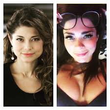 Haz click en follow para seguir icifacial y las. Antonella Rios Muestra Como Cambio Su Rostro Al Sacarse Las Bolas De Bichat
