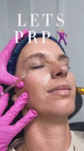 LETS PRP!🩸Who’s ready to see these results??? I know we are excited to  show you! 😌🪄 #wherebeautymeetshealthandwellness #medspanearme  #RevitalizeSabine #ManyLA #medspamarketing #PRP #PRPtherapy ...