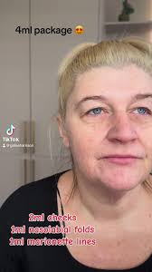 Can we just look at this transformation again 😍 •• Cheeks