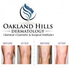 This practice sees patients at 2 locations. Varicose Vein Treatment In Auburn Hills Mi Oakland Hills Dermatology