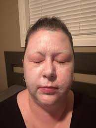 Pomelo scrub benefits for skin