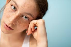 The sooner you can act on it, the better. How To Get Rid Of Spots Fast Superdrug