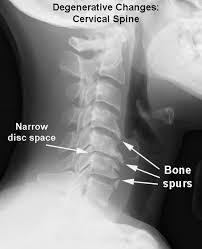 Pin On Pain