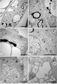 Image result for Trema sp A