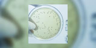 De l'agent infectieux aux traitements en passant par les mesures sanitaires, l'essentiel sur cette redoutable bactérie. Legionellose Maladie Du Legionnaire Aussi En Belgique E Sante Be E Sante