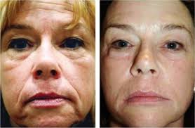 TOP 10 BEST Light Therapy in Los Angeles, CA