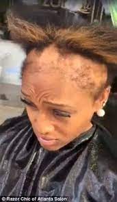 👑 weave severely damaged my hair 👑 3 month hair update rice water ?? Hairstylist Warns About How Damaging Weaves Can Be Severe Hair Loss Hair Loss Women Razor Chic Of Atlanta