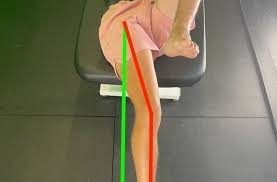 Image result for Thomas Test