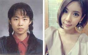 31 Crazy Before And After Photos Of Korean Plastic Surgery Korean Plastic Surgery Celebrity Plastic Surgery Plastic Surgery