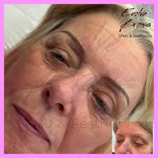 Evolve Brows & Aesthetics Dronfield