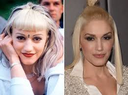 Gwen Stefani Eye Surgery Gwen Stefani Before And After Beautyeditor Hair Implants Laser Hair Laser Hair Removal