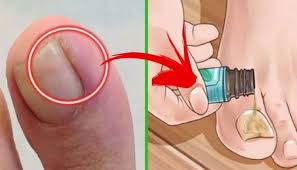 bilgi panosundaki pin