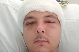 Fundraiser by Linda Borowski : Dad recovering from brain surgery needs your  help!