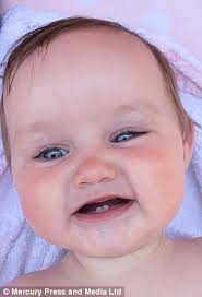 Wythenshawe mother launches petition for newborns' heads to be measured to  spot growths