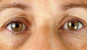 Meski tidak berbahaya, kantong mata dan lingkaran hitam di sekitar mata bisa membuat penampilan jadi tidak segar. Cara Cara Untuk Menghilangkan Lingkaran Hitam Bawah Mata Hanya Mengunakan Bahan Semulajadi