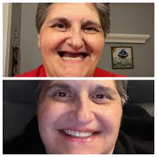 Hi everyone!! Just giving an update! I had a bone graph done