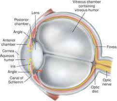 Glaucoma is a group of eye diseases which result in damage to the optic nerve (or retina) and cause vision loss. Glaucoma Definition Of Glaucoma By Medical Dictionary