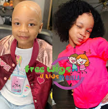 Regular tensile stress can lead to serious hair loss conditions, such as traction alopecia, which can be caused by wearing tight hairstyles for a long period of time. Atlanta Mom Makes Free Custom Wigs For Children With Hair Loss Hey Black Mom