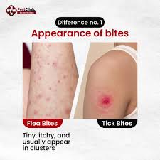 Image result for flea bite